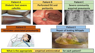 Antibiotic selection for the most 5 common infectious disease in critically ill patients [upl. by Ilwain]