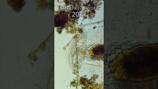 Collotheca Rotifer Unfurling to eat [upl. by Agna]