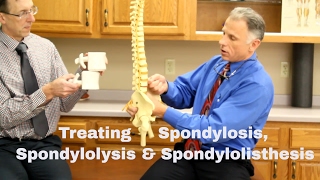 Treating Spondylosis Spondylolysis amp Spondylolisthesis Lumbar Spine [upl. by Nalrah]