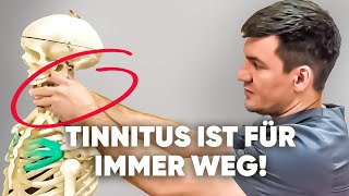 3 Hauptursachen für Tinnitus Hab das gemacht und alles war weg [upl. by Ebbie828]