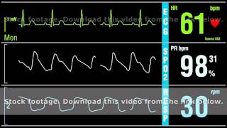 Patient monitor displays medical exam vital signs [upl. by Lamej237]