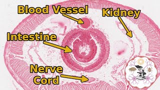 Earthworm Microscopic Anatomy  A Transverse Section [upl. by Einnod]