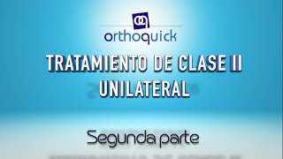 TRATAMIENTO DE CLASE II UNILATERAL SEGUNDA PARTE [upl. by Joub145]