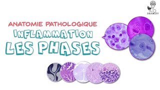 Anatomie Pathologique  Phases de lInflammation [upl. by Otilia58]