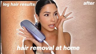 I TRIED LASER HAIR REMOVAL AT HOME this is what happened [upl. by Ogeid561]