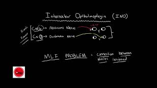 Internuclear ophthalmoplegia INO BASIC amp QUICK EXPLANATION [upl. by Linell653]