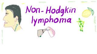 NonHodgkins lymphoma NHL Bcell and Tcell  Aggressive and Indolent [upl. by Thanh]