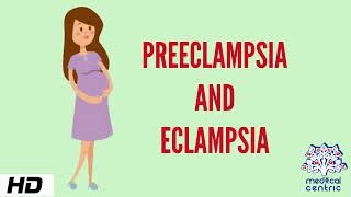 Preeclampsia and Eclampsia Causes Signs and Symptoms Diagnosis and Treatment [upl. by Siocnarf]