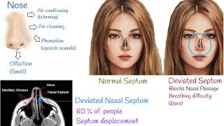 Deviated septum symptoms treatments and causes Nasal Septal deviation [upl. by Adali]