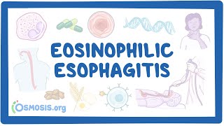 Eosinophilic esophagitis NORD [upl. by Hnid606]