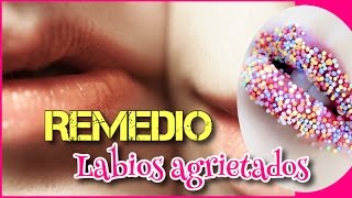 Labios rojos secos agrietados cómo prevenirlo Remedios labios cortados [upl. by Maddis]