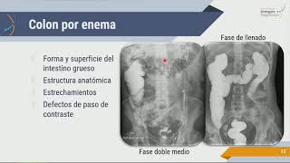 Radiología de Abdomen Estudios Contrastados [upl. by Belicia160]