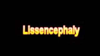 What Is The Definition Of Lissencephaly [upl. by Nnylaj]