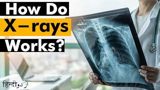 How Do Xrays Works  Xrays types UrduHindi [upl. by Gnaoh]