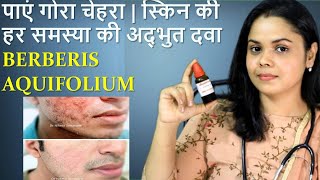 Berberis Aquifolium Homeopathic medicine for fairness acne pimples problems [upl. by Adoree]