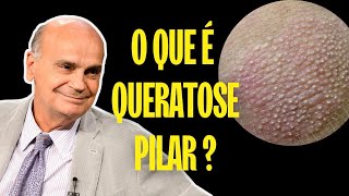 O QUE É QUERATOSE PILAR PELE DE GALINHA [upl. by Gatian]