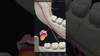 Error 1  Técnica de anestesia para el nervio alveolar inferior odontologia dentales [upl. by Enelaj]