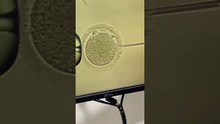 Intracytoplasmic Sperm Injection ICSI [upl. by Erl]