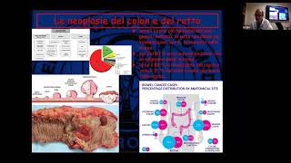 2311 Le neoplasie del colonretto  Prof Zobel e Prof Saba [upl. by Toogood591]