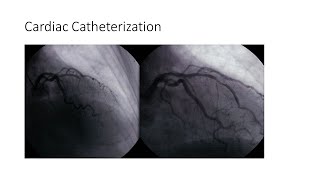 Cardiac Catheterization [upl. by Halonna]