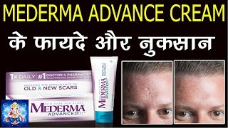 MEDERMA CREAM uses side effects full review in hindi चेहरे के निशान को ख़त्म करने की दवाई [upl. by Vernice]