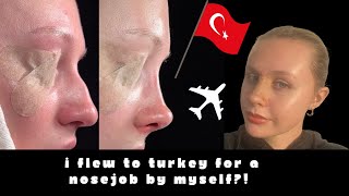 I flew ALONE to Turkey for a closed rhinoplasty NOSE JOB hospital tests recovery amp cast removal [upl. by Wilden]