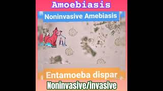 Noninvasive Amoebiasis E dispar 🤔 👍Parasitology👌🔬✅ [upl. by Sipple]