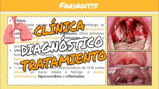 ⚕️🩺FARINGITISFARINGOAMIGDALITIS y HERPANGINA SíntomasTratamiento [upl. by Enyr]