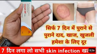 clorash gm cream  antifungal cream  दाद खाज खुजली की दवाई  क्लोराश जीएम क्रीम [upl. by Reamy425]