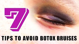 Bruising from Botox  7 tips to avoid Botox Bruises [upl. by Phyllis835]