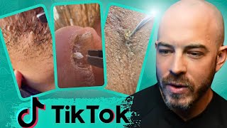 Dermatologist reacts to Crazy TikTok Videos [upl. by Akiemahs]