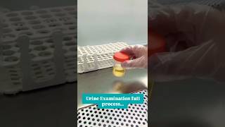 Urine exam fluid process [upl. by Aiekam6]