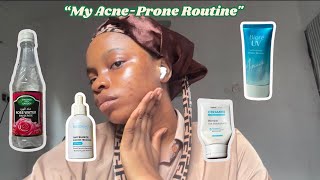 Affordable Skincare for Acne Recovery My AcneProne Routine [upl. by Sihon]