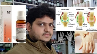 rheumatoid arthritis homeopathic medicine for rheumatoid arthritis explain [upl. by Nalac]