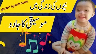 down syndrome musicbecho pr music ka asrdown syndrome music therapy SmilewithUnaisa [upl. by Strawn]