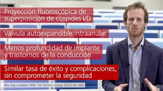 Técnica de superposición de cúspides en TAVI con el sistema Portico FlexNav [upl. by Eekram]