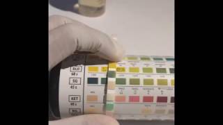 UTI dipstick test Urine Analysis [upl. by Akimahs]