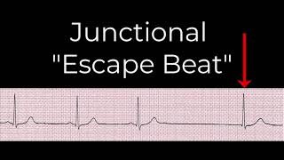 8 Junctional rhythms [upl. by Nayek]