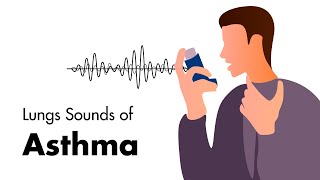 Sounds of Asthma  Wheezing Lung Sounds [upl. by Atiuqan338]