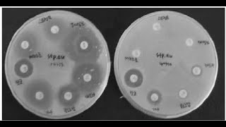 Antibiotic susceptibility testing [upl. by Charmane]