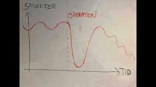 Smerter efter operation for diskusprolaps [upl. by Ennaerb]