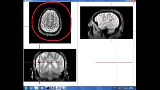 cerveau et motricité volontaire [upl. by Zehe]