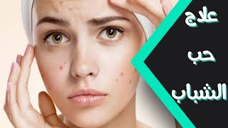 علاج حب الشباب  علاج الحبوب في الوجه  حب الشباب  acne [upl. by Sherborne796]