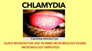 Chlamydia  Microbiology  Bacteriology Trachoma Quick revision for 2nd yr MBBS microbiology exams [upl. by Sneed471]