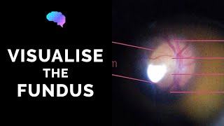 Fundoscopy  How to Visualise the Fundus  Direct Ophthalmoscopy  OSCE Guide  UKMLA  CPSA [upl. by Irik646]