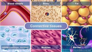 Understanding Soft Tissue Sarcoma [upl. by Enak635]