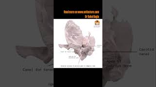 Anatomy of Temporal Bone  Link in Description  Dr Rahul Bagla Teaching ENT [upl. by Rainer]