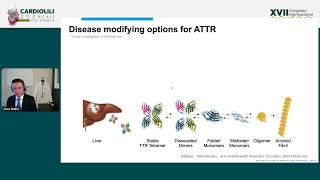 New pharmacological targets in amyloidosis cardiomyopathy What is the future  José Nativi [upl. by Danae523]