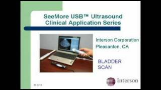 SeeMore Ultrasound Bladder Scan [upl. by Rosalee]