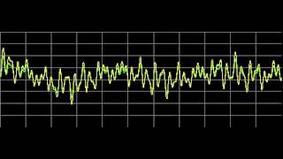 Liver Diseases  Rife Frequencies [upl. by Yessac]